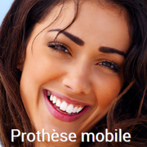 Restauration du sourire par prothese mobile complete